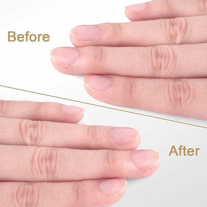 Easkep Cuticle Trimmer and Pusher, Professional Stainless Steel Cuticle Cutter - Image 6