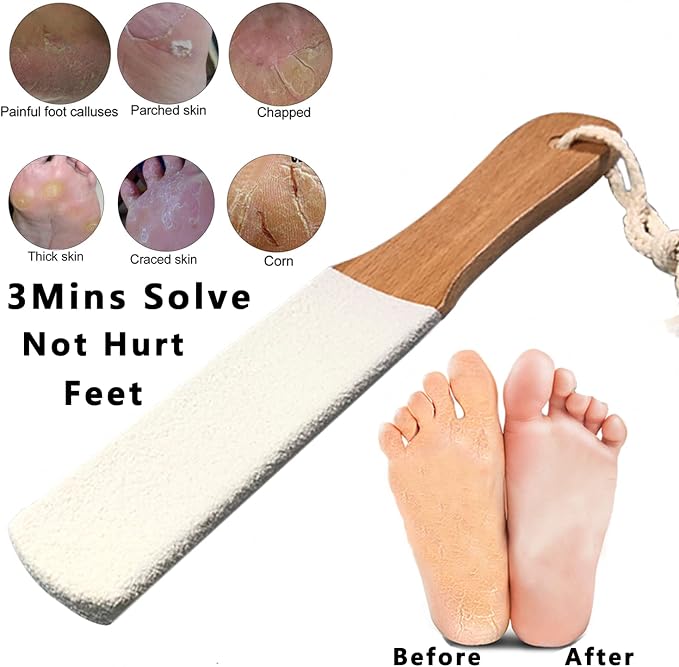 Kinepi Feet Callus Removers Professional Colossal Foot Scrubber Pedicure Foot - Image 3