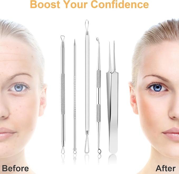 UUBAAR 9PCS Blackhead Remover Tools, Pimple Popper Tool Kit - Image 2