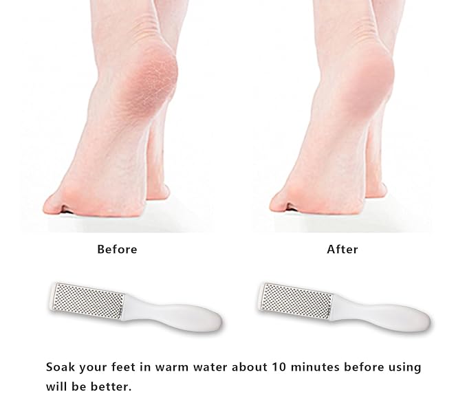 Professional Foot Files Callus Remover, Foot Scrubber - Image 4