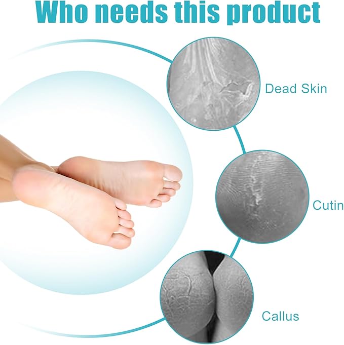Foot File Callus Remover-2 Pcs 4 in 1 Foot Scrubber Dead Skin Remover - Image 7