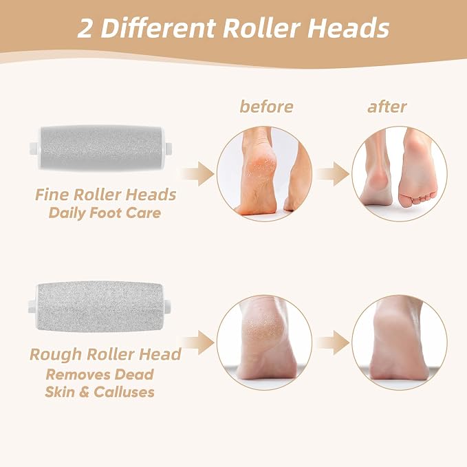 Electric Foot Callus Remover, Electronic Foot File, Portable Electric Callus - Image 8