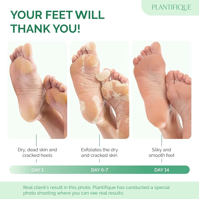 PLANTIFIQUE Foot Peeling Mask 2 Pack | Dermatologically Tested Repairs Heels & - Image 2