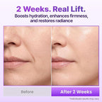 BIOHEAL BOH Probioderm 3D Lifting Cream Mist 3.38 fl oz | Korean Face Mist - Image 7