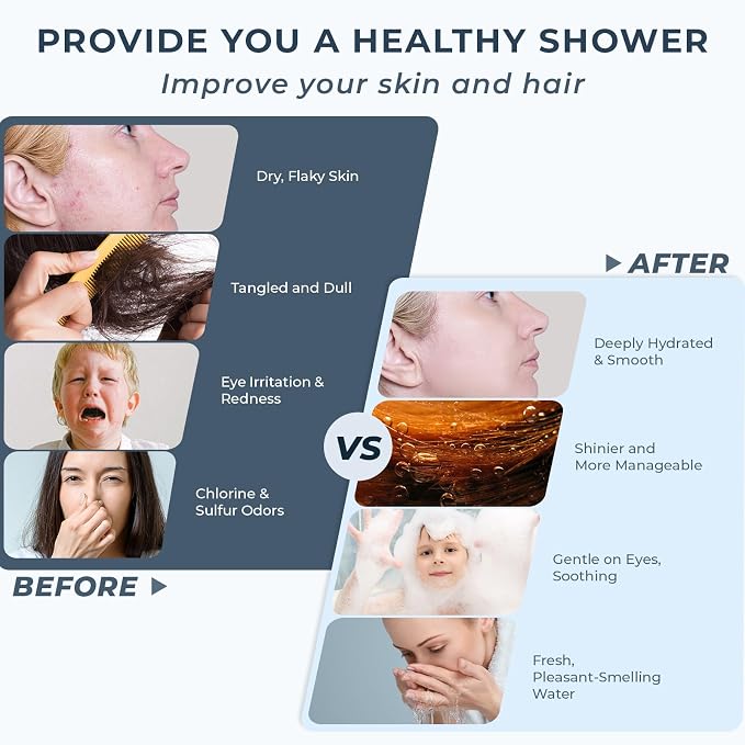 Ryamen 2026 Magnetic Filtered Shower Head - Image 4