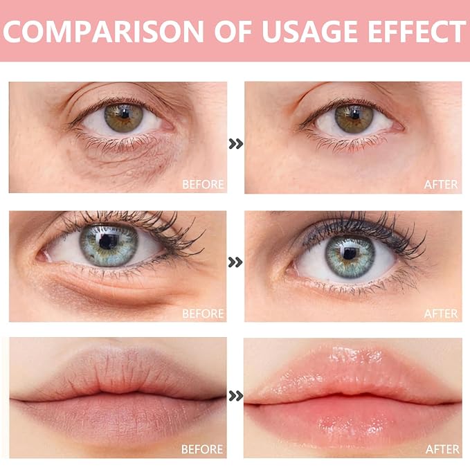30 Pairs Lip Mask & Eye Mask, Under Eye Patches - Image 7