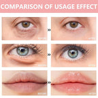 30 Pairs Lip Mask & Eye Mask, Under Eye Patches - Image 7
