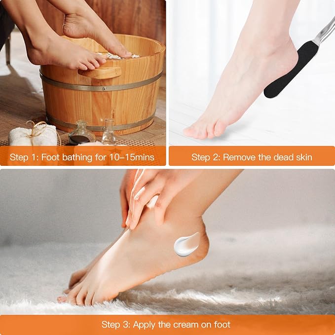 Biutee Foot File for Dead Skin Pedicure Foot Files Callus Remover Professional - Image 4