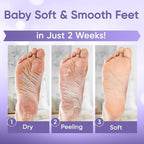 CÉLOR Foot Peeling Mask for Dry Cracked Feet | Foot Mask to Exfoliate Rough - Image 4