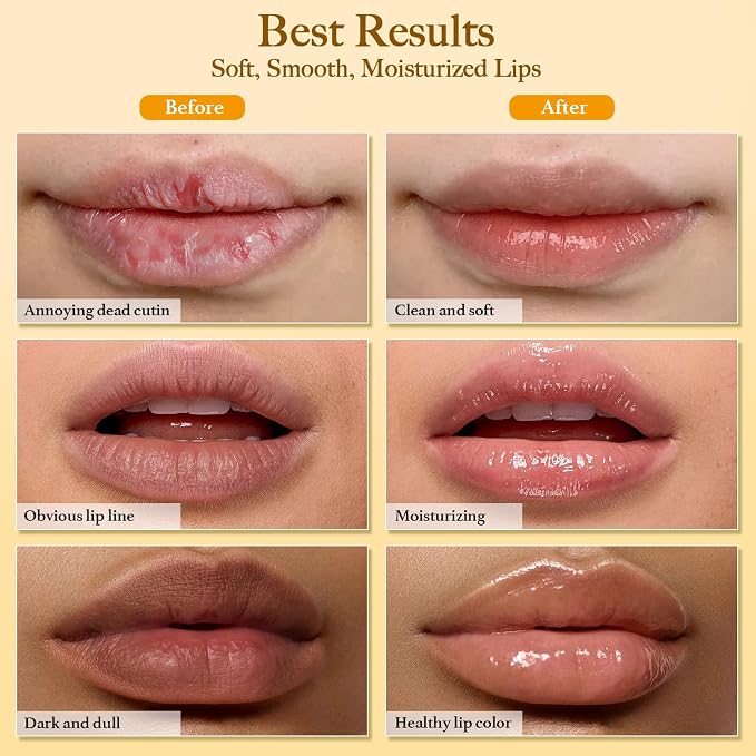 3PCS Turmeric Lip scrub 100g and Turmeric Lip Balm, Lip Scrubber Exfoliator - Image 5