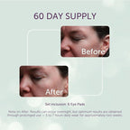 Silc Skin Silicone Eye Pads Reusable Overnight Eye Patches, Medical Grade - Image 3