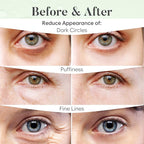 BLOOMORA Green Tea Under Eye Patches - Image 4