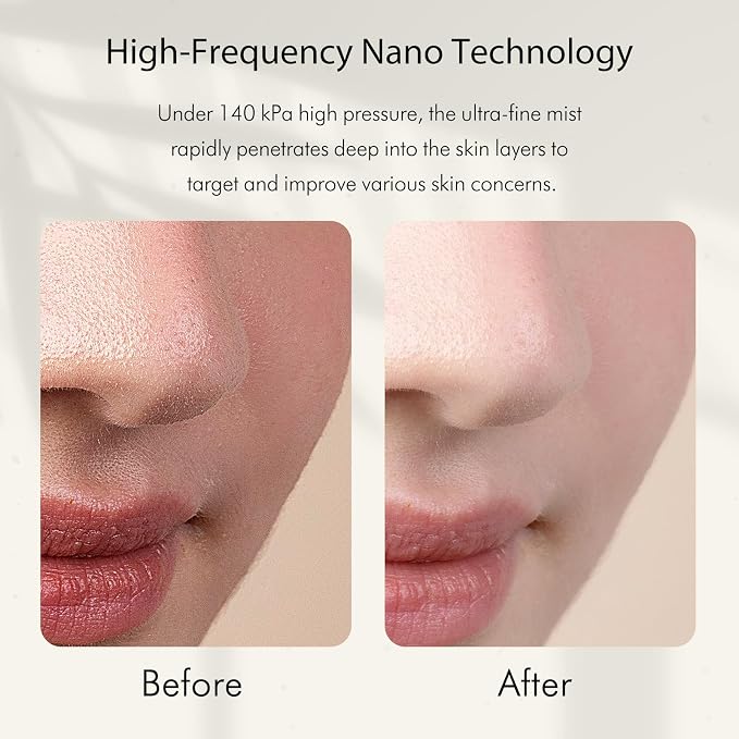 Facial Oxygen Spray Machine - Image 4