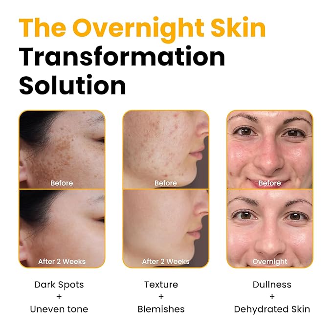 QUIA Turmeric + Kojic Acid Overnight Wrapping Mask – Hydration Mask - Image 3
