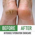 PurOrganica Urea Cream 40% – Made in USA, Maximum Strength Foot Cream - Image 6