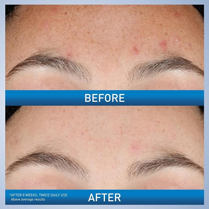 CeraVe Resurfacing Retinol Serum - Image 3