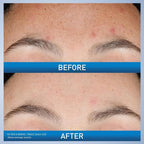 CeraVe Resurfacing Retinol Serum - Image 3