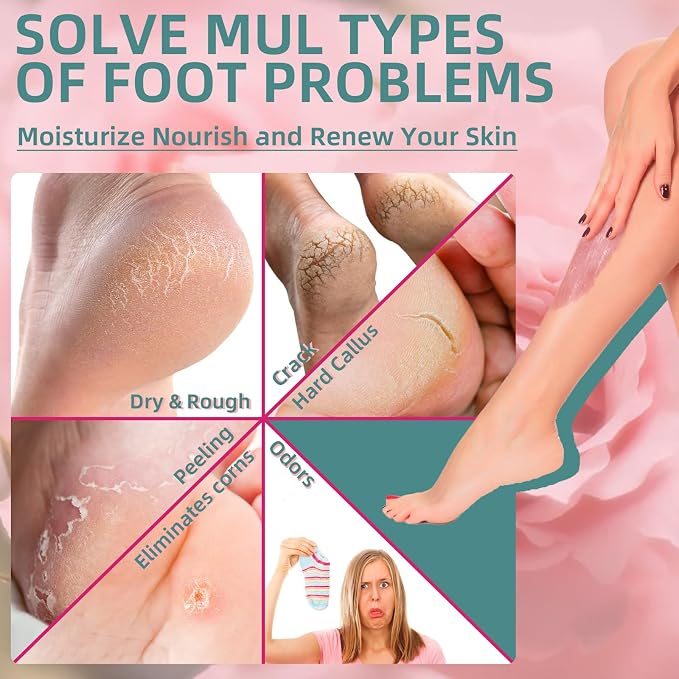 Foot Exfoliating Scrub, Sugar Scrub, Dead Skin Remover - Image 2