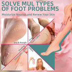 Foot Exfoliating Scrub, Sugar Scrub, Dead Skin Remover - Image 2