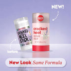 Onyx Professional Cracked Heel Repair Balm Stick - Image 2