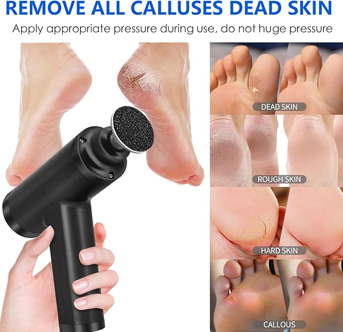 Upgraded Electric Callus Remover - Image 5