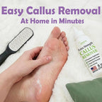 Callus Remover Gel & Double-Sided Foot File: 8 oz Extra Strength Callus Remover - Image 5