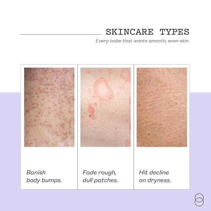 frank body Niacinamide Body Scrub | Fights Breakouts & Dryness | Exfoliating - Image 6