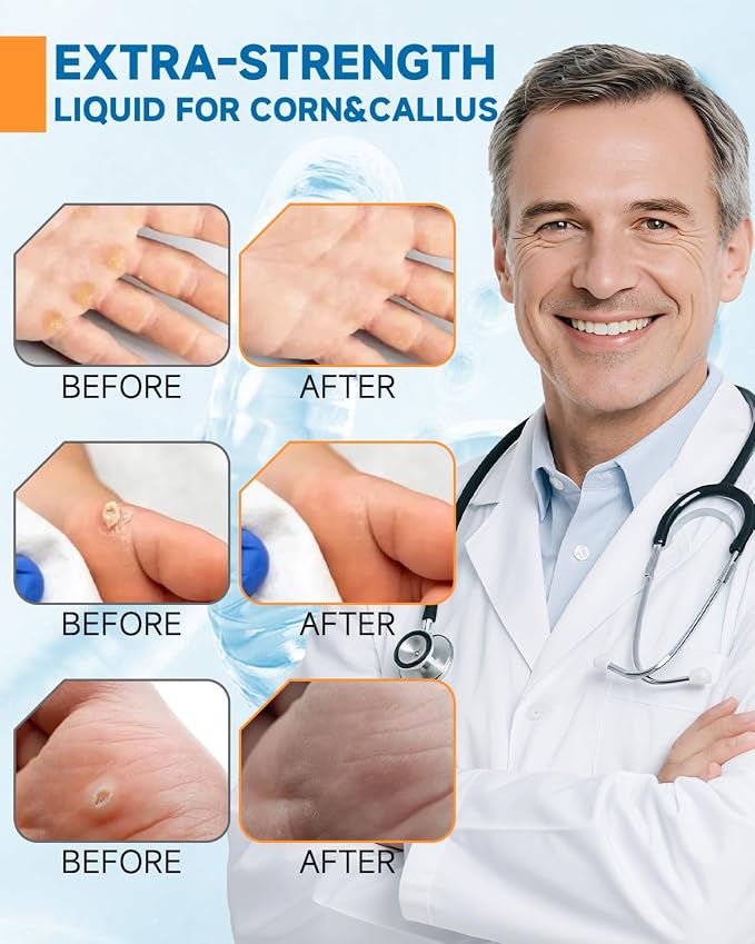 MQFORU Liquid Corn & Callus Removers - Image 7