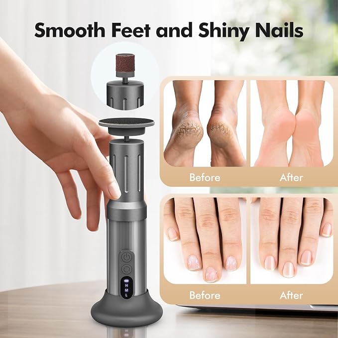 Electric Foot Callus Remover Cordless Electric Foot Filer Kit - Image 6