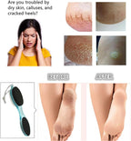 Foot File Callus Remover 4-in-1, Feet Scraper Pedicure Tools - Image 3