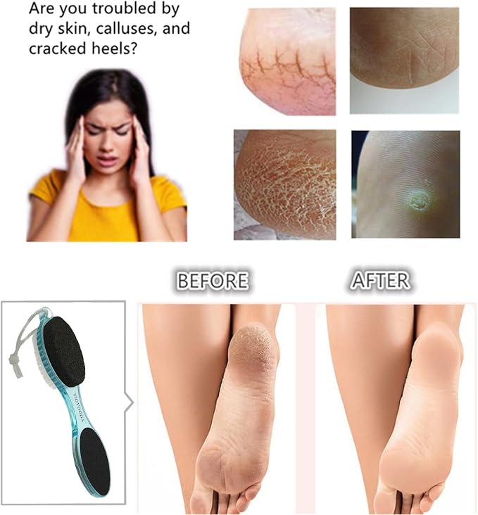 Foot File Callus Remover 4-in-1, Scrubber Brush, Foot Rasp and Sand Paper - Image 3