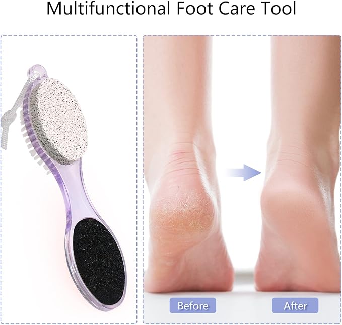 2-Pack 4 in 1 Pedicure Tool Callus Remover - Image 7