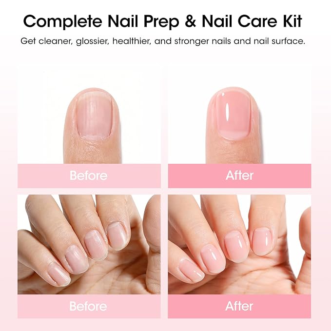 Gellen Nail Care Kit Manicure Tools Kit: Nail Strengthener and 2Pcs Nail File & - Image 2