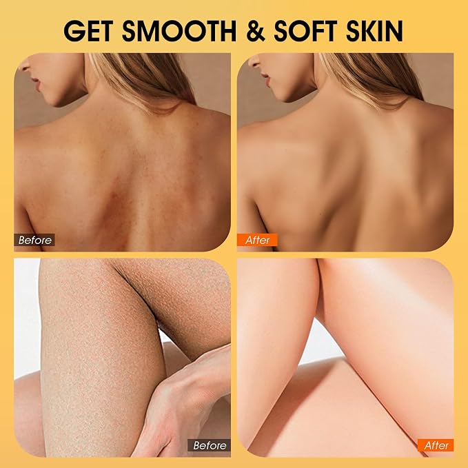 VOERUY Body Scrub, Turmeric Exfoliating Body Scrub, - Image 4