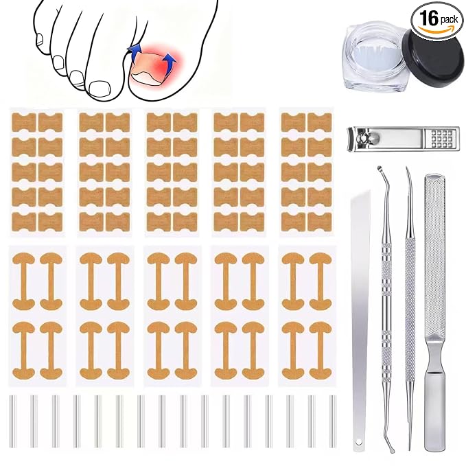 Ingrown Toenail Corrector Set by Unknown