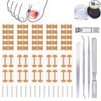Ingrown Toenail Corrector Set by Unknown