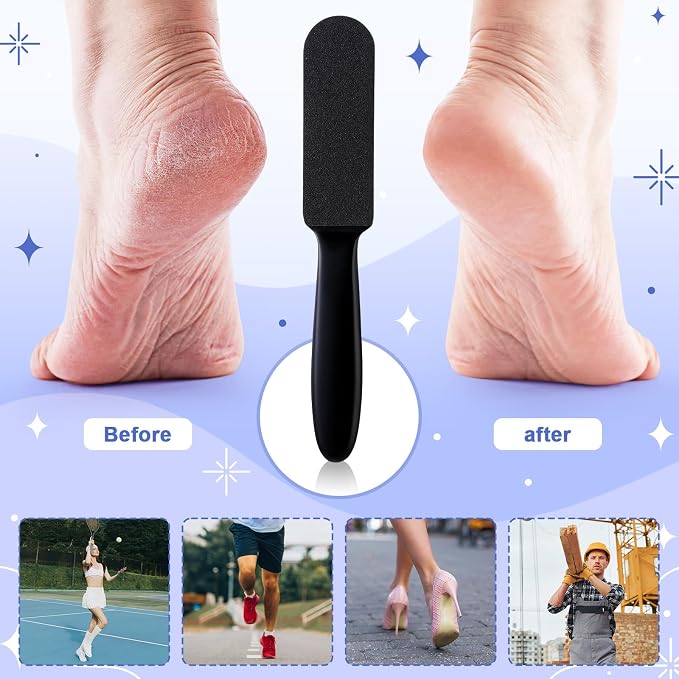 Mudder 2 Pieces Stainless Steel Pedicure Foot File Callus Remover Foot Scrubber - Image 4