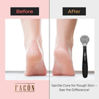 Facón Professional Callus Shaver Remover - Image 3