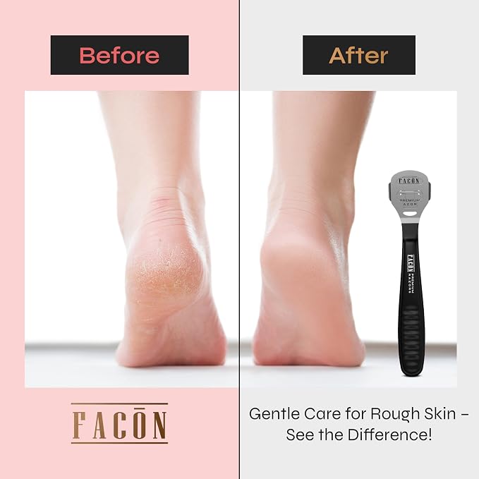 Facón Professional Callus Shaver Remover - Image 3
