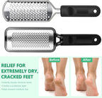 Professional Pedicure File and Callus Remover - Image 7