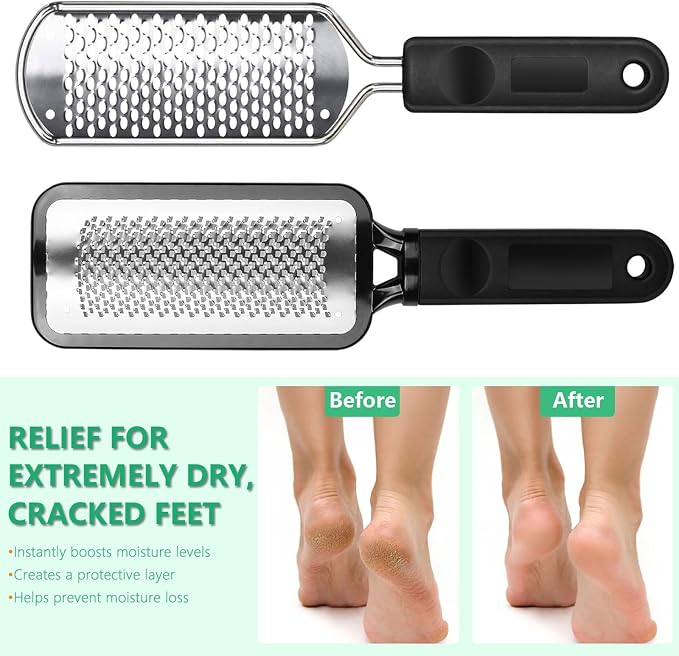 Professional Pedicure File and Callus Remover - Image 7