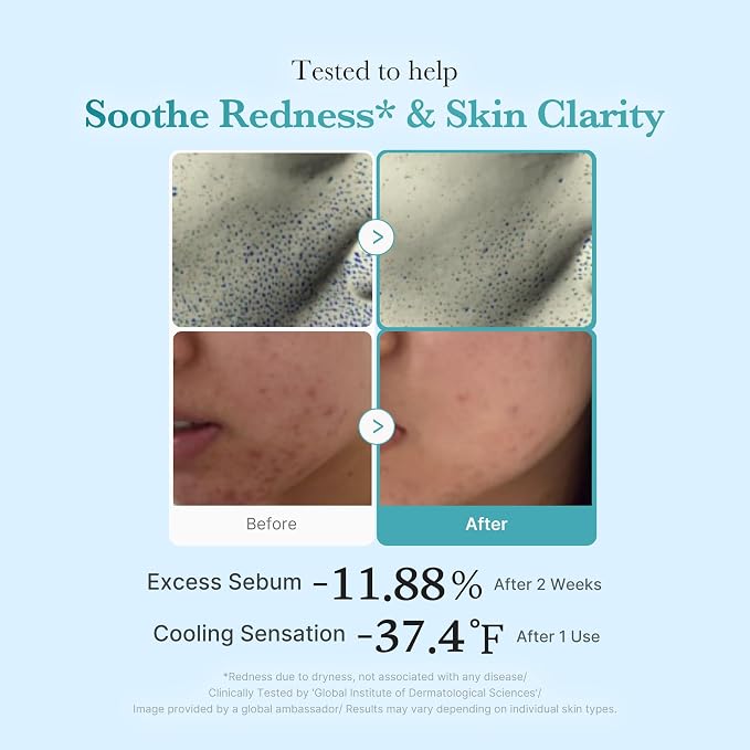 medicube Azelaic Acid Niacinamide Clarifying Toner | Troubled Skin Care - Image 4