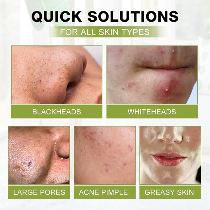 SHVYOG Blackhead Peel Off Face Mask, 3-in-1 Blackhead Remover Mask - Image 5