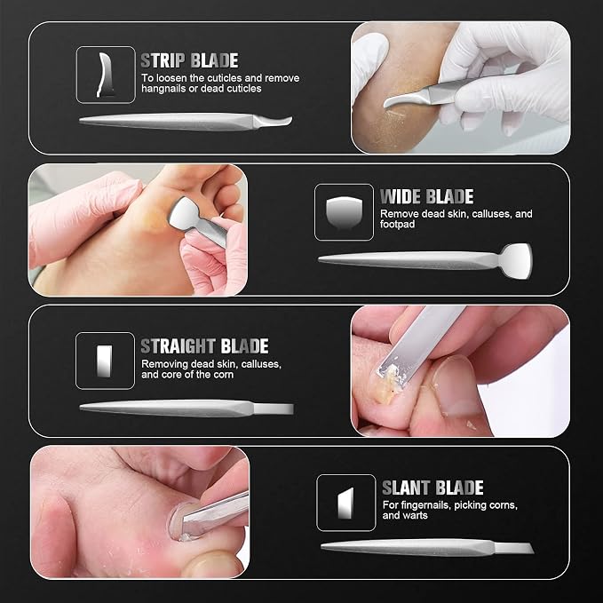 FERYES Pedicure Knife Ingrown Toenail Kit, Top Notch Foot Blade - Image 4