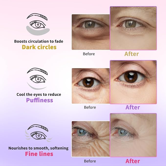 AILEORY Under Eye Patches for Dark Circles, Fine Lines, Eye Mask Set - Image 4