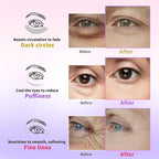 AILEORY Under Eye Patches for Dark Circles, Fine Lines, Eye Mask Set - Image 4