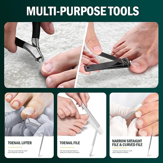 FVION Ingrown Toenail Tools Kit 5 Pcs, Toenail Clippers - Image 4
