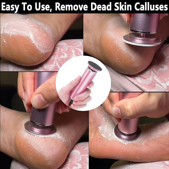 Electric Foot File Callus Remover - Image 2