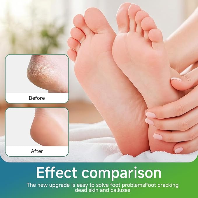 2Pcs Nano Glass Foot File, Nano-Glass Foot File, Foot Scraper - Image 3