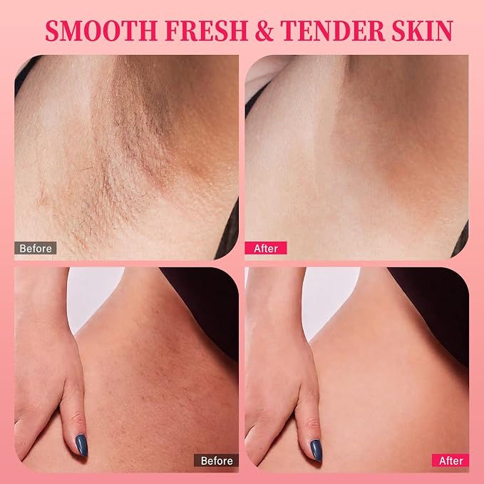 Bikini Area Exfoliator with 10% AHAs BHA & Vitamin C, Exfoliating Body Scrub - Image 4